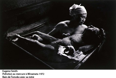 Eugene Smith : Minamata